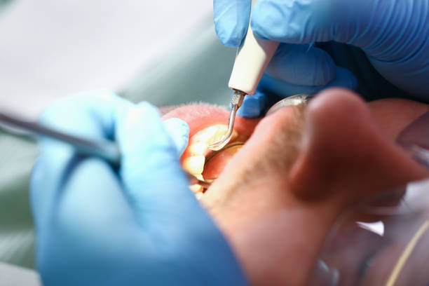 Best Emergency TMJ Treatment in Tuskegee, AL
