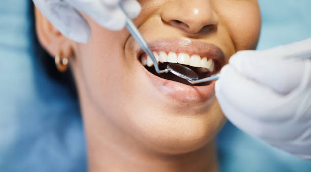Best Emergency Gum Treatment in Tuskegee, AL